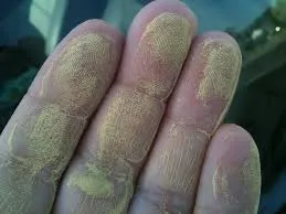 Pollen Blooming Plants Negative Effects on Indoor Air Quality And Triggers Allergies